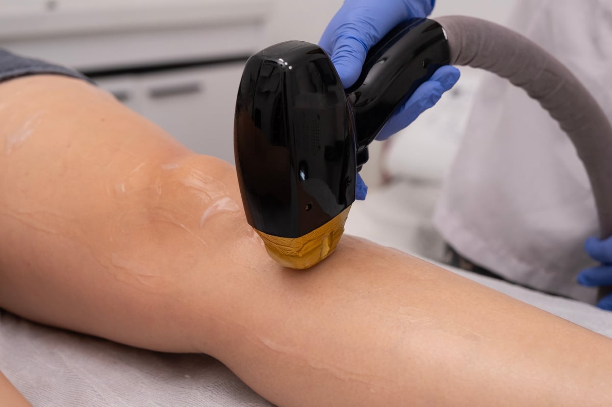 Laser epilation - hair removal procedure